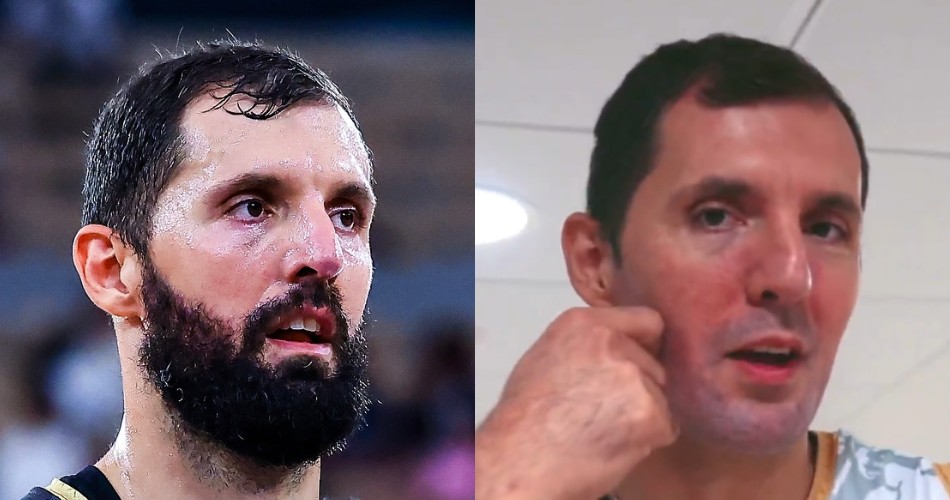 Nikola-Mirotic-Monaco-clean-shaved